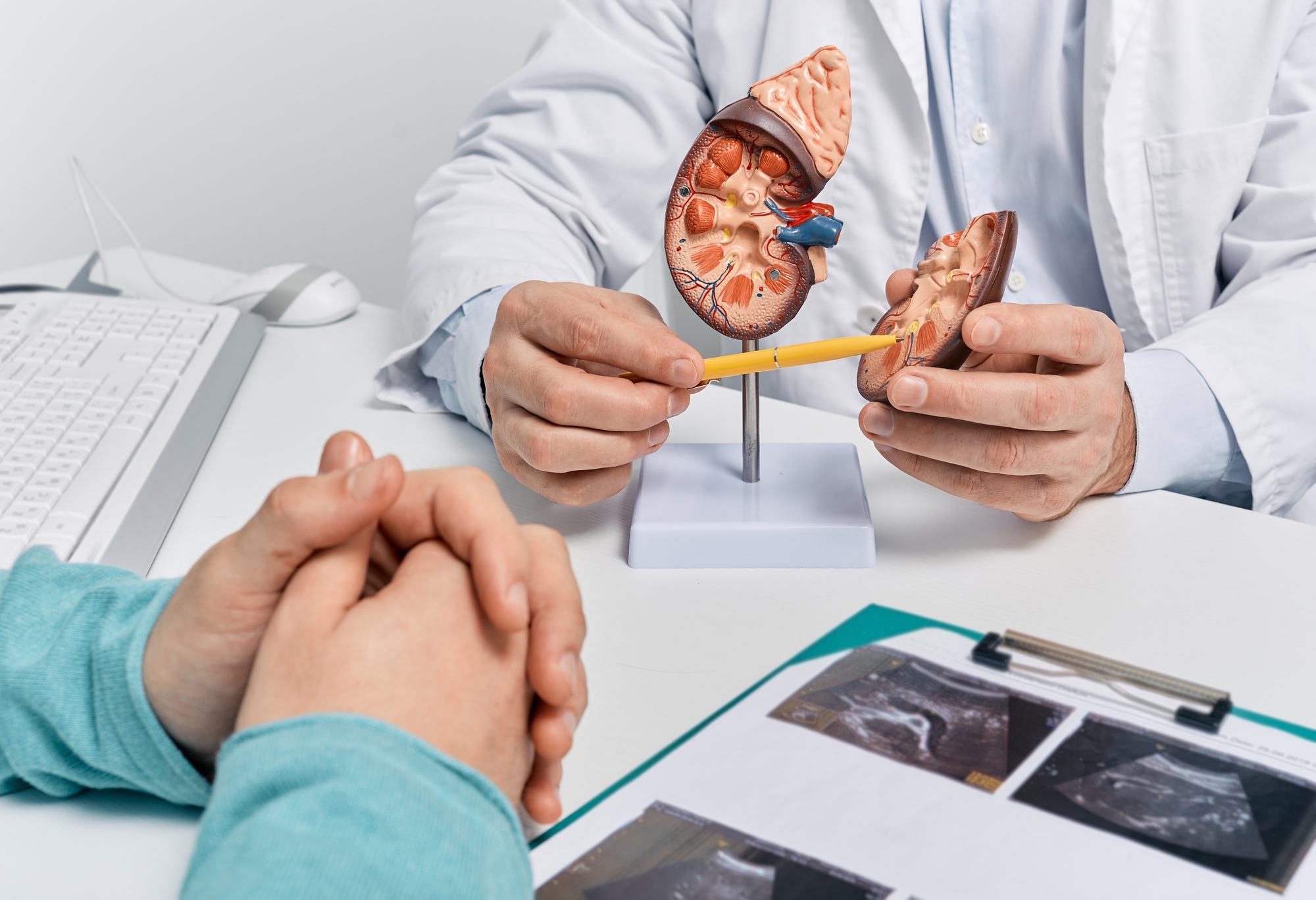 Urology and treatment of kidney disease. Doctor analyzing of patient kidney health using kidney